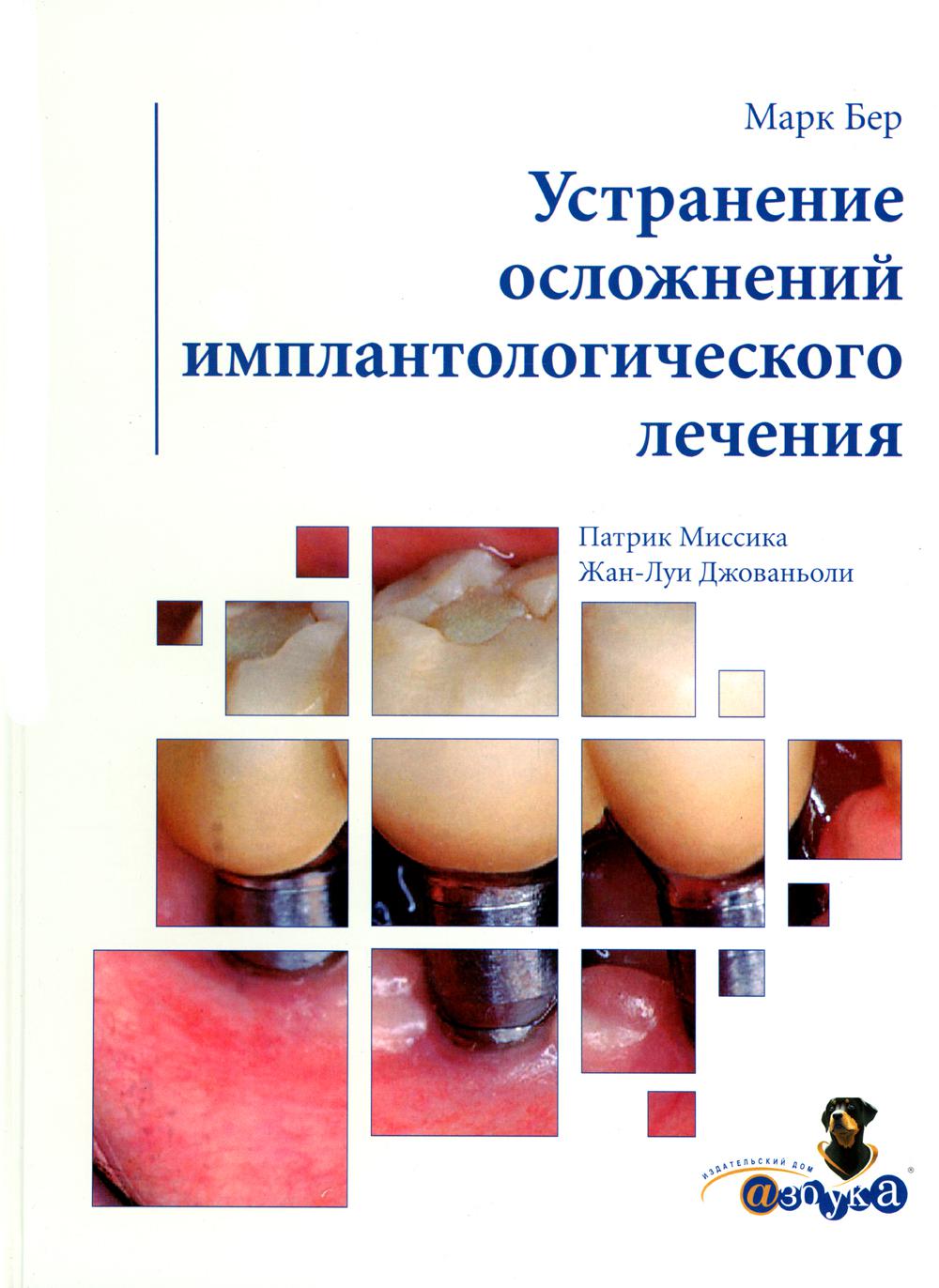 Марк Бер.Устранение осложнений имплантологического лечения, М., 2007  Джованьоли Ж.-Л., Бер М., Миссика П. russian book купить в Канаде | russian  book